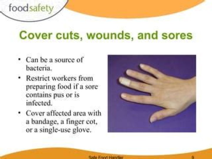 The Infected Food Handler's Finger And Its Impact