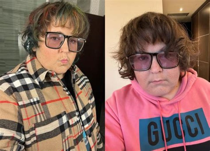 Unveiling The Secrets Of Andy Milonakis' Condition: Discoveries And Insights