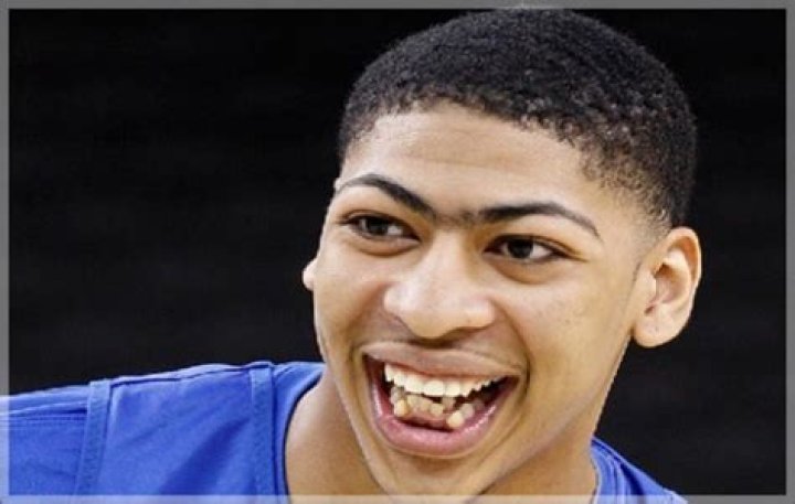 Unveiling Anthony Davis's Before Smile: A Journey Through Time
