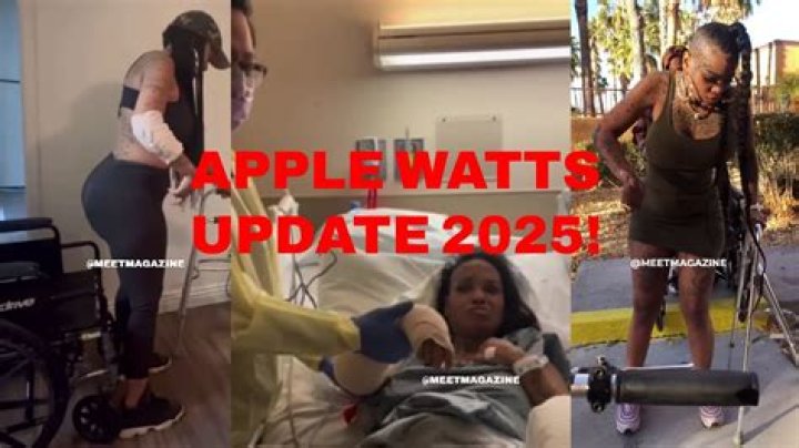 Unveiling The Truth: Apple Watts Accident