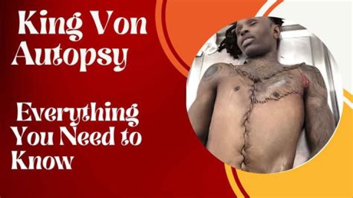 King Von Autopsy Reveals Startling Findings