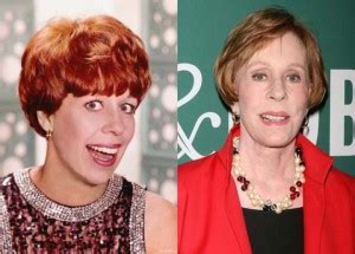 Unveiling The Secrets Of The Carol Burnett Facelift: Discoveries And Insights