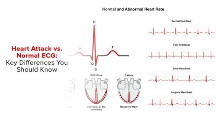 Discover The Power Of "Check Mark Vs Heart" On Raya: Insights And Strategies Revealed