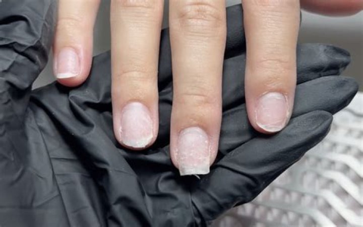 The Secrets Your Nails Reveal