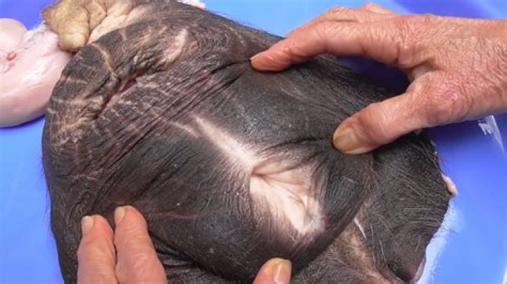 Unveiling Anatomy, Functions, And More