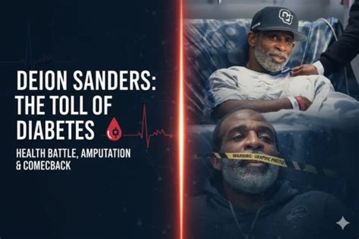 Decoding Deion Sanders' Journey: Unlocking Diabetes Management Secrets
