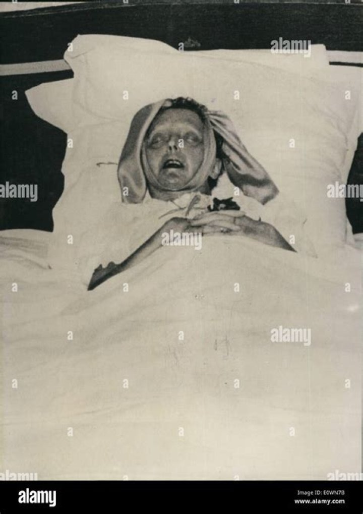 Edith Piaf's Cause Of Death And Its Impact On The Music World