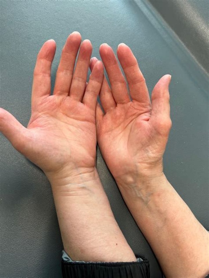 Exploring Elton John's Public Display Of Colby's Wrists