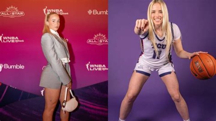 Unveiling The Power Behind Hailey Van Lith's Face Scar: Resilience, Inspiration, And Triumph