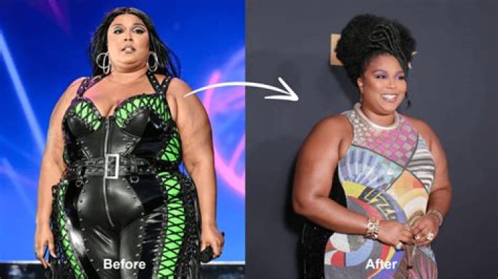 Unveiling The Cost Enigma Of Lizzo's Weight Loss Surgery: Insights And Revelations
