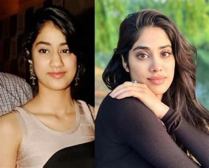 Unveiling Janhvi Kapoor's Plastic Surgery Journey: Insights And Revelations