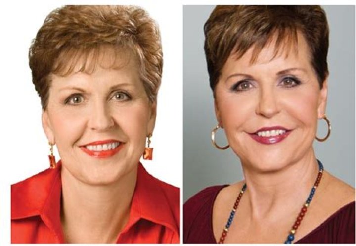 Joyce Meyer Botox: Uncovering The Surprising Truth