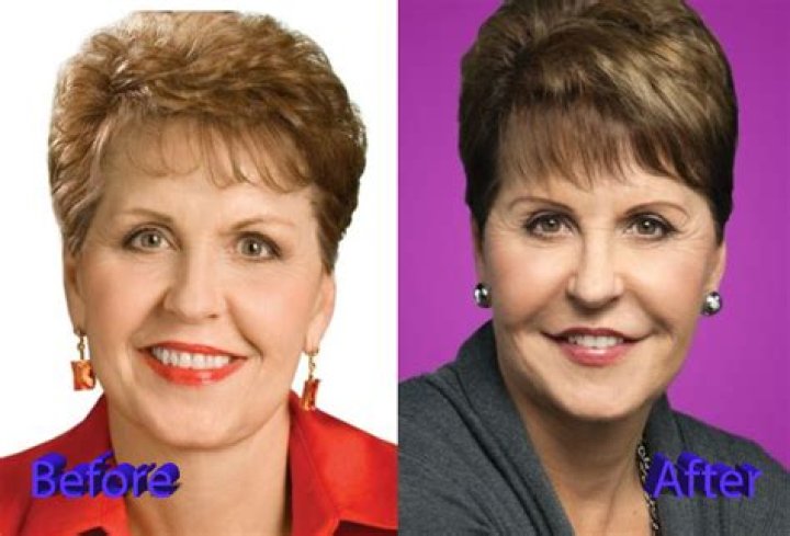 Unveiling The Secrets Of The "Joyce Meyer Facelift": Discoveries And Insights