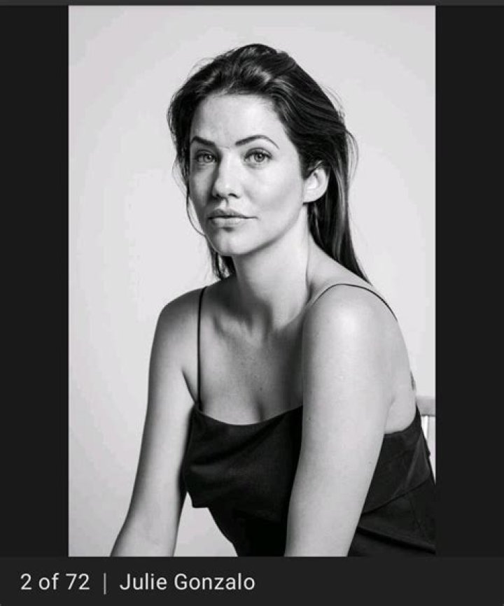Julie Gonzalo's Face Scar Explored