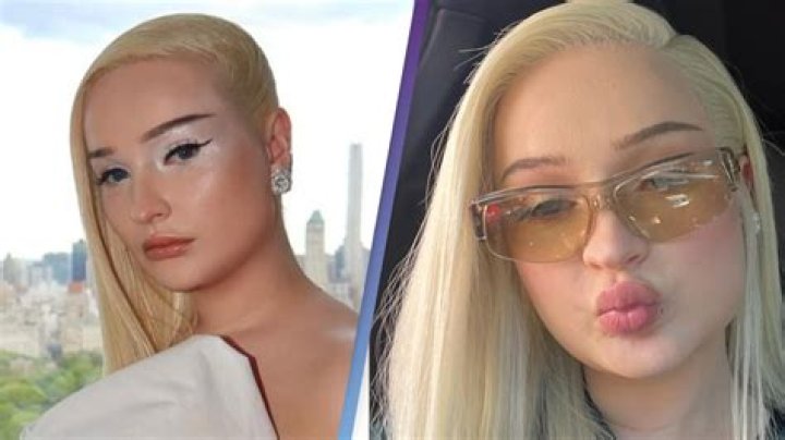 Unveiling Kim Petras' Plastic Surgery Journey: Discoveries And Insights
