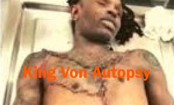 Shocking Revelations From King Von's Autopsy Report