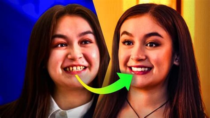 Discover The Meaning And Significance Of "Kitty XO Teeth"