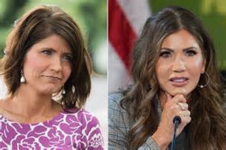 Kristi Noem's Cosmetic Surgery Journey Unraveled