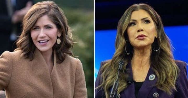 Kristy Noem's Plastic Surgery Journey Explored