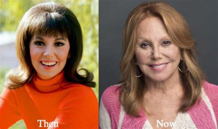 Unveiling The Truth Behind Marlo Thomas's Plastic Surgeries