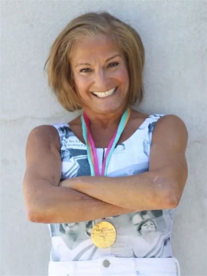 Mary Lou Retton's Triumph Over Surgeries