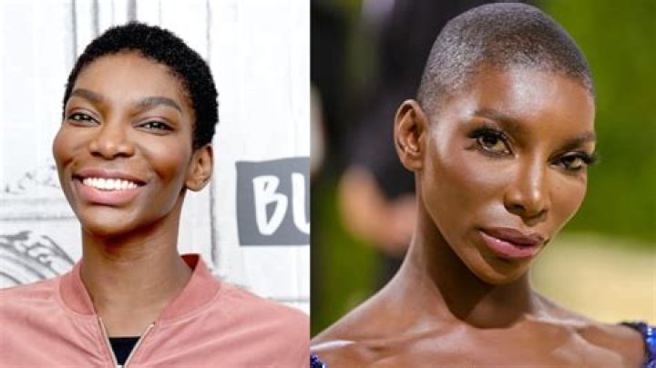 Michaela Coel's Fibroid Surgery Journey
