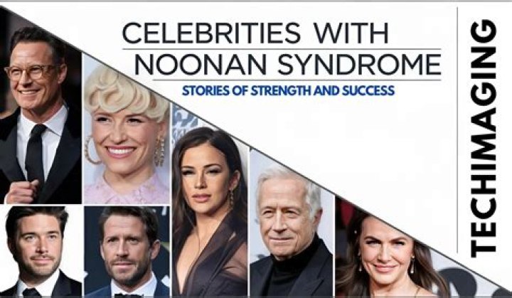 Unveiling The Stories Of Noonan Syndrome: Celebrities, Challenges, And Triumphs