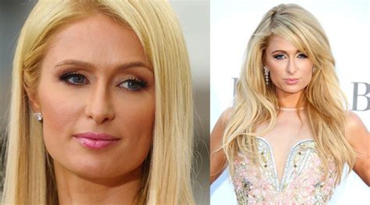 Unveiling The Secrets Of Paris Hilton's Transformation