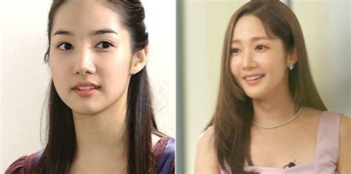 Park Min Young's Transformation Before The Spotlight