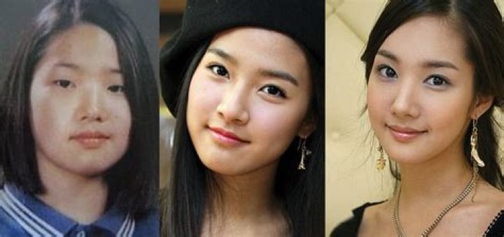 Unveiling Park Min Young's Transformation: Before Plastic Surgery