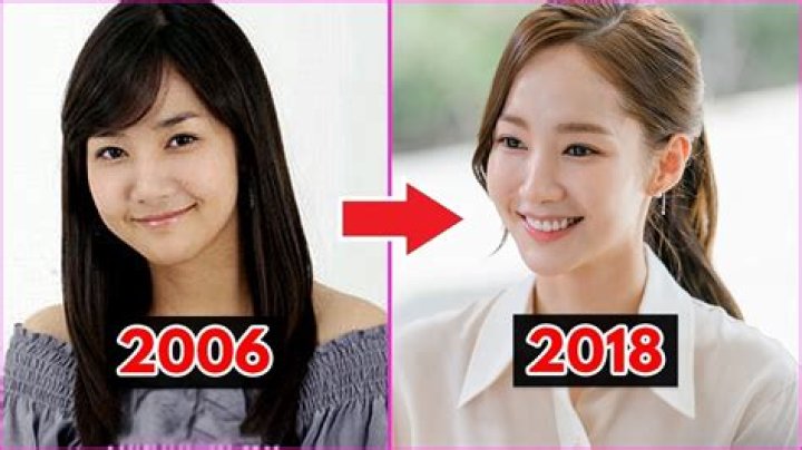 Unveiling Park Min-young's Surgery: Secrets, Risks, And Revelations