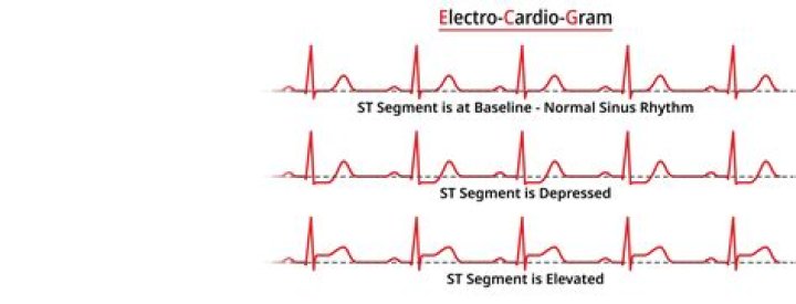 Unlock The Secrets Of Raya Check Vs Heart: Uncover Hidden Insights