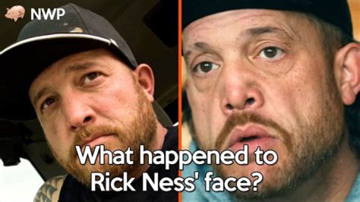 Unveiling The Secrets Of "Rick Ness Face": A Comprehensive Guide