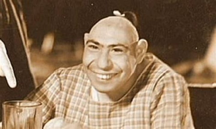 Unveiling The Cause Of Schlitzie's Untimely Demise: Discoveries And Insights