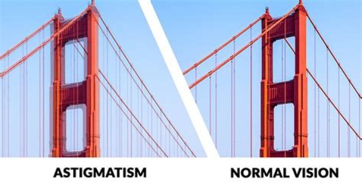 A Journey To Clear Vision