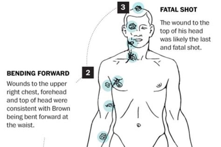 Timothy Ferguson Autopsy Report: Unlocking The Mystery