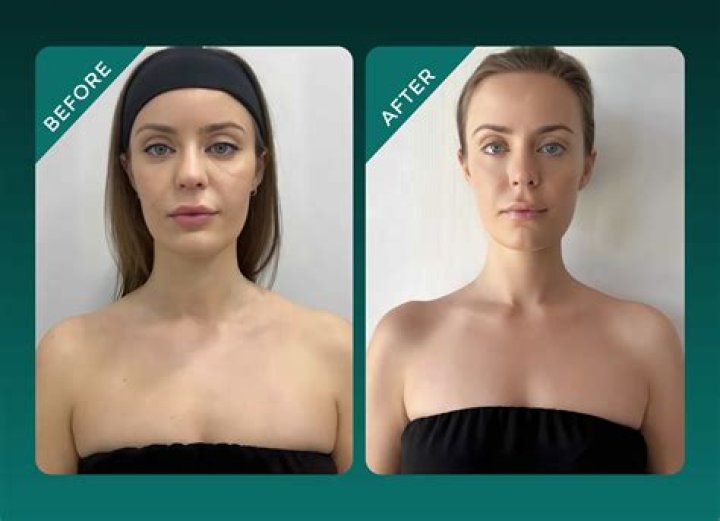 Unveiling The Secrets To A Sculpted Jawline