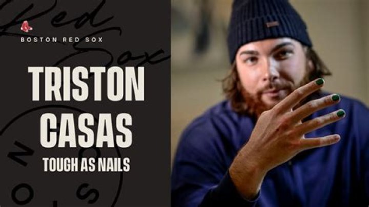 Unveiling The Story Behind Triston Casas' Painted Nails: Discoveries And Insights