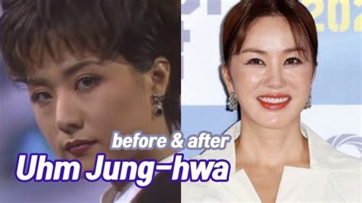 Unraveling Uhm Jung Hwa's Plastic Surgery Journey