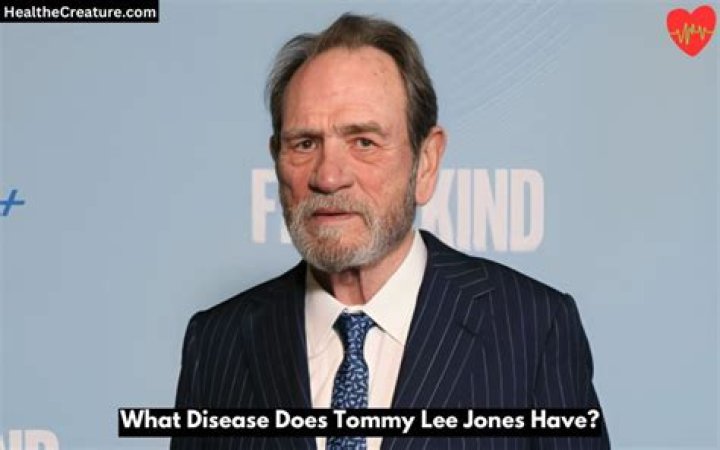 Unveiling Tommy Lee Jones' Health Journey: Exploring His Diabetes Diagnosis