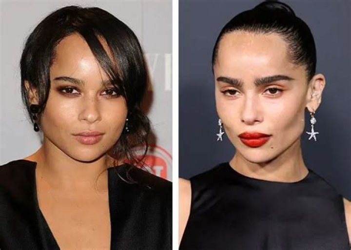 Zoe Kravitz's Plastic Surgery Journey: Uncovering The Truth